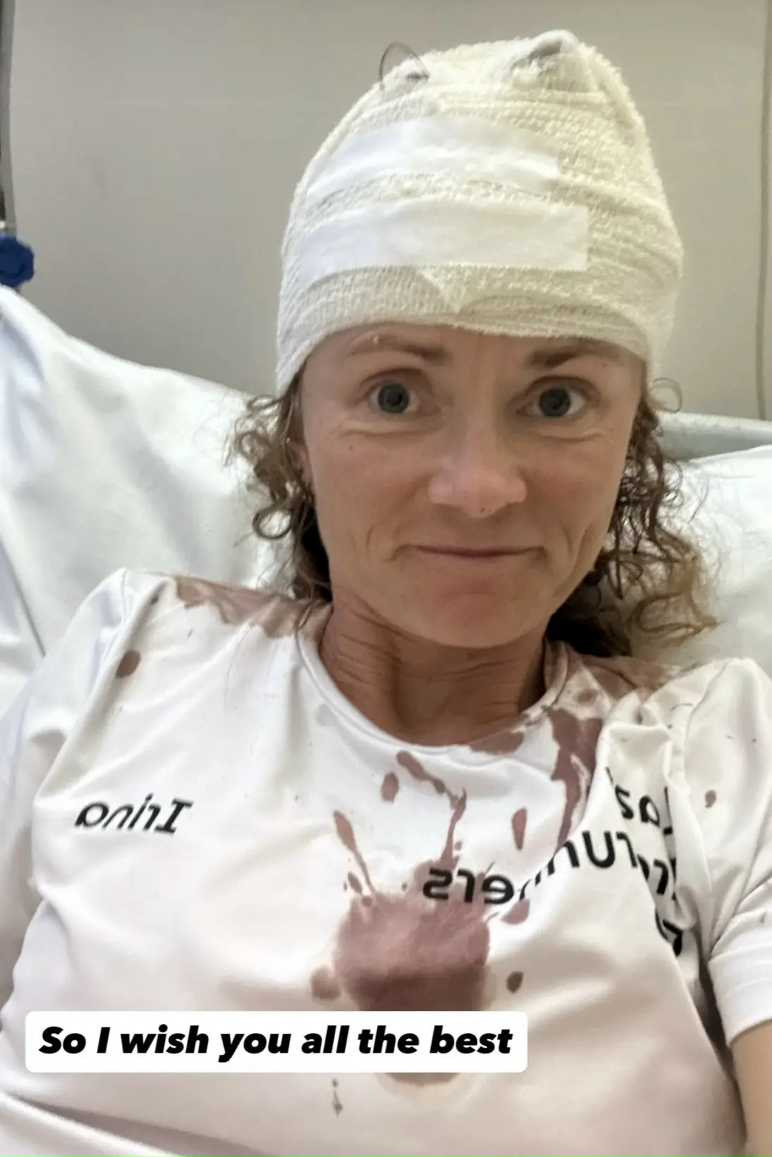 Российская легкоатлетка пострадала от нападения собак на Кипре